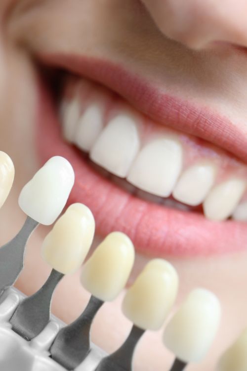 Wybielanie zębów Łowicz